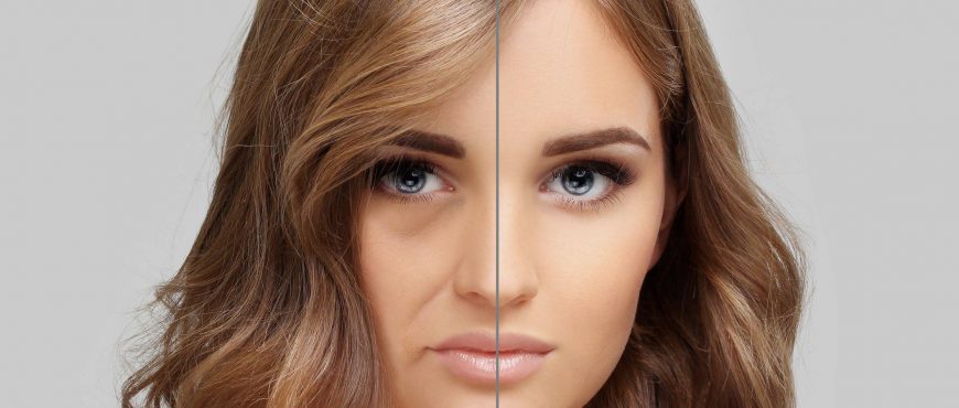 tratament-mezoterapie-injectabila-galati