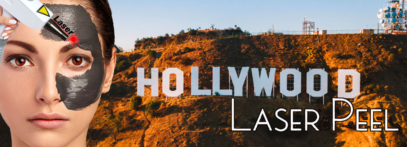 laser carbon peel galati